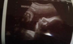 photo e7445dbd-fde0-4517-8681-18c845d5631d_zps644c5dc0.jpg