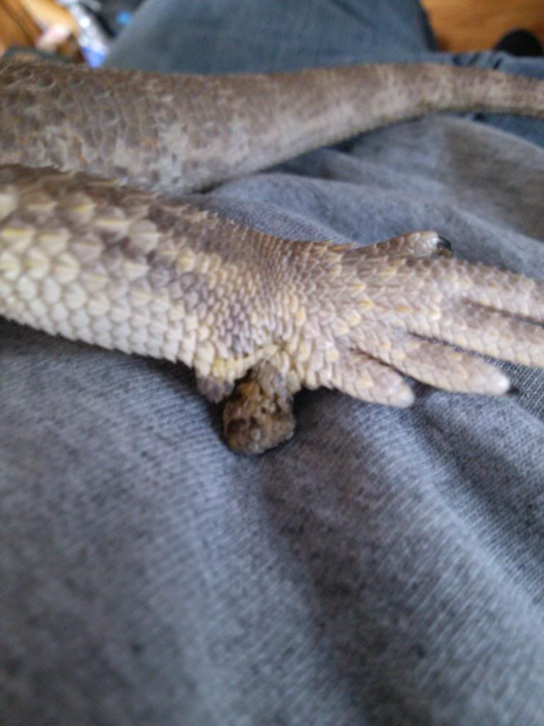 Lump on foot about the size of pencil eraser Health