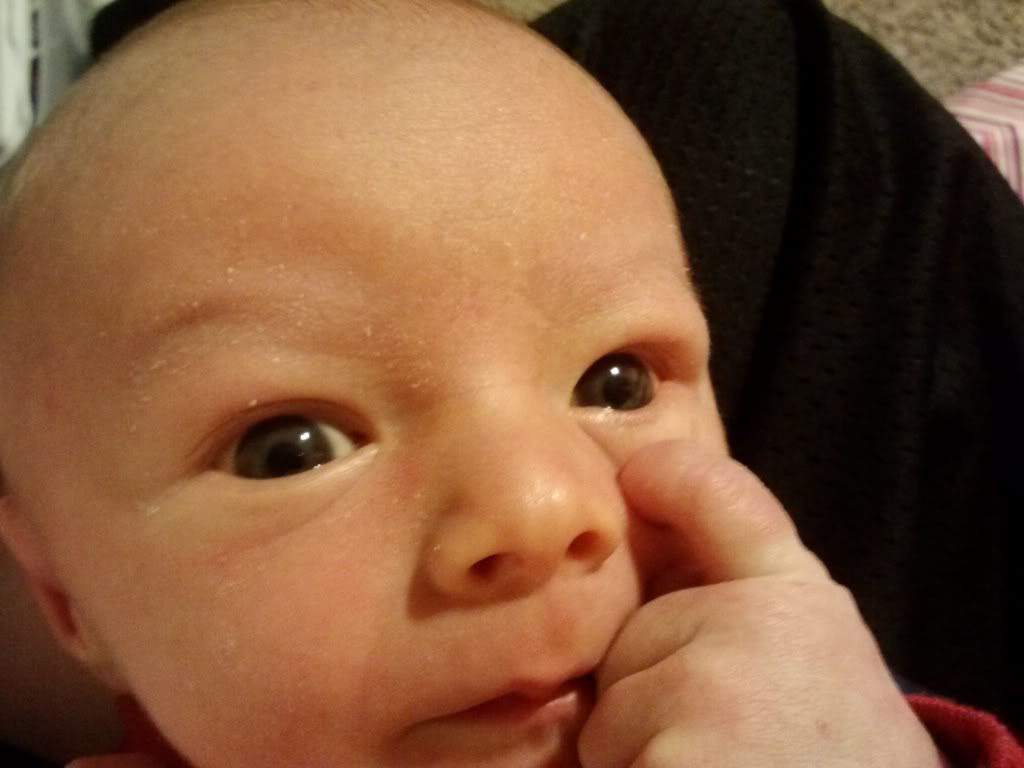 swollen-eye-on-newborn-babycenter