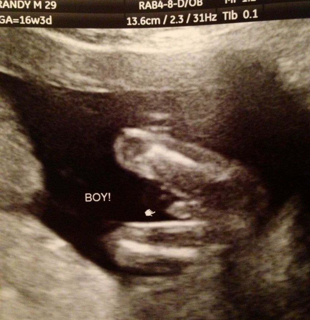 Tech says BOY I don't see scrotum?! BabyCenter